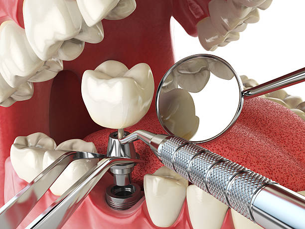 Best Emergency Dental Care for Broken or Chipped Teeth in Reminderville, OH